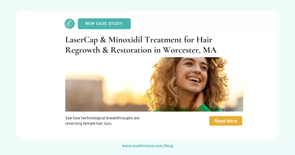 Blog Post OG_ LaserCap and Minoxidil Treatment for Hair Regrowth & Restoration in Worcester MA (1)